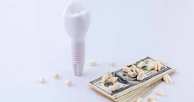 Dental implant resting next to money and loose teeth